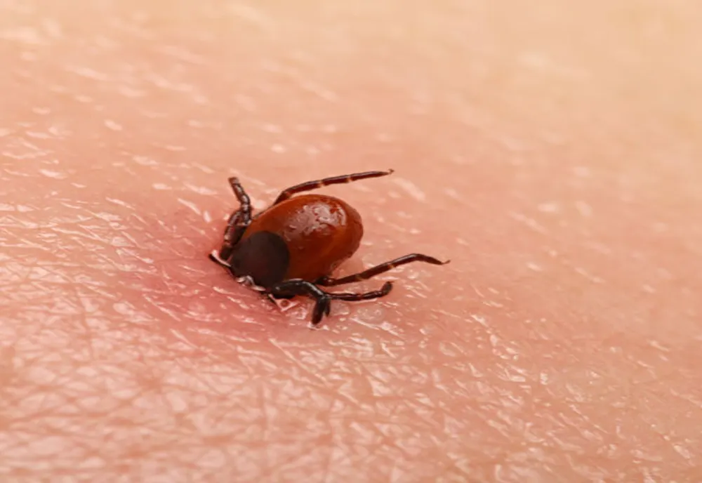 Altă problemă cu care se confruntă medicii. Val de pacienți mușcați de căpușe