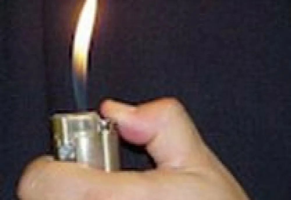 Un tânăr de 17 ani și-a dat foc într-un centru de plasament din Buzău