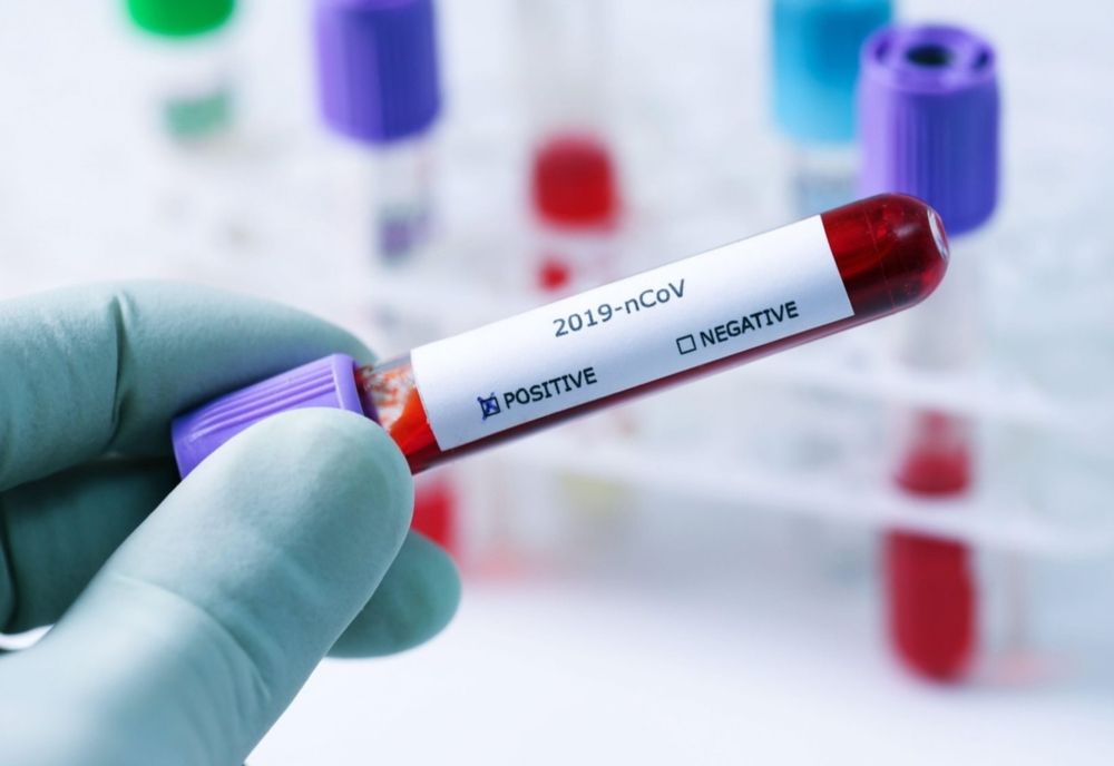 42 de cazuri noi și 5 decese ale unor pacienți infectați cu COVID-19