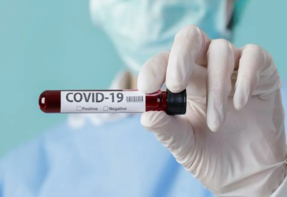 Bilanț COVID pentru ultimele 24 de ore:  808 cazuri noi și 23 de decese/ 464 dintre infectați se află pe secțiile ATI
