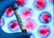 Coronavirus: 158 de cazuri confirmate, la Buzău