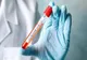 Șapte noi cazuri de Coronavirus, la Buzău, S-a înregistrat al optulea deces